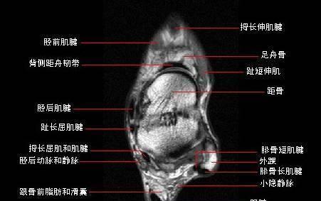 以咩咩启示录（揭秘咩咩启示录游戏的规则与策略）